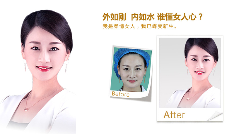 保定V脸、线雕隆鼻